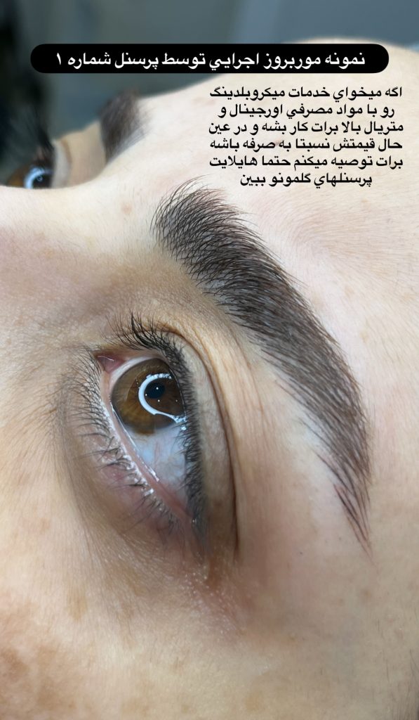 میکروبلیدینگ پرسنل شماره یک غزاله حاجی زاده